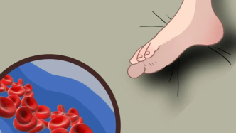 腿抽筋、愛磨牙、半夜總醒……可能是這些地方“堵”了