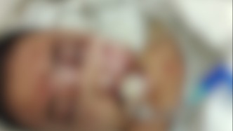 14歲自閉癥男孩意外墜樓骨碎大出血，媽媽崩潰大哭