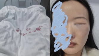 女游客稱因換房糾紛遭店方毆打，四川阿壩松潘縣警方和文旅局已介入