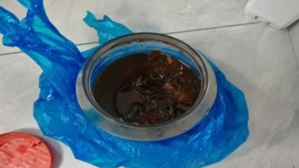 五旬男子飲用藥酒后中毒昏迷，原來是含有曼陀羅成分