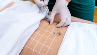 澎湃思想周報｜當產后迅速恢復遇上減肥針；紀念阿倫特：重建喜悅與團結的公共生活