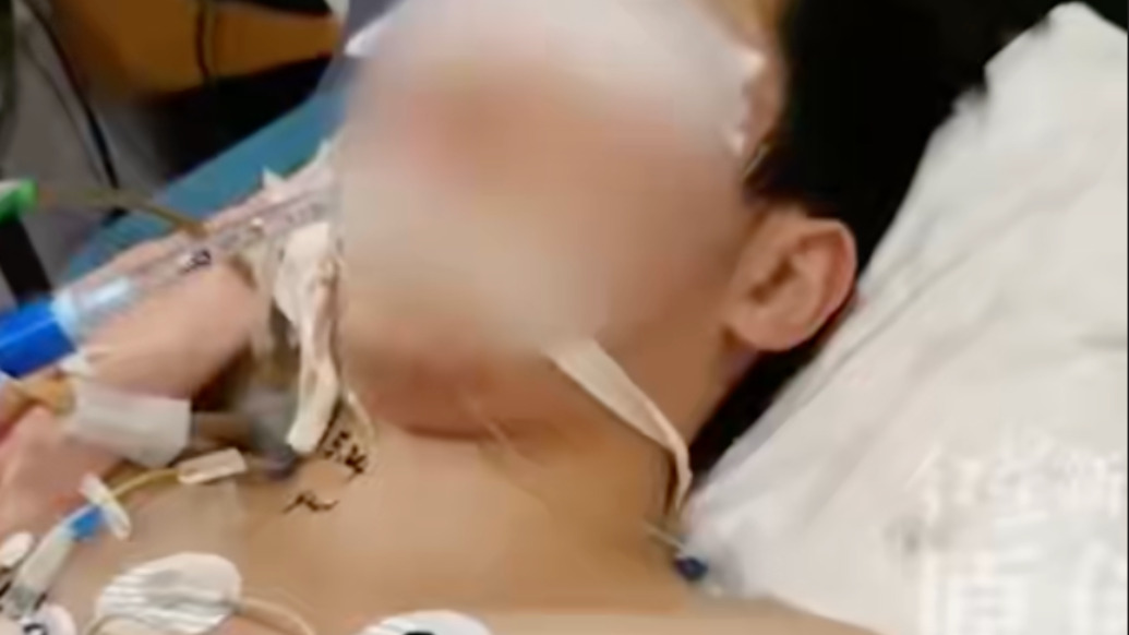 14歲男生被女同學打中左胸后癱瘓，家屬勝訴卻得不到錢治療