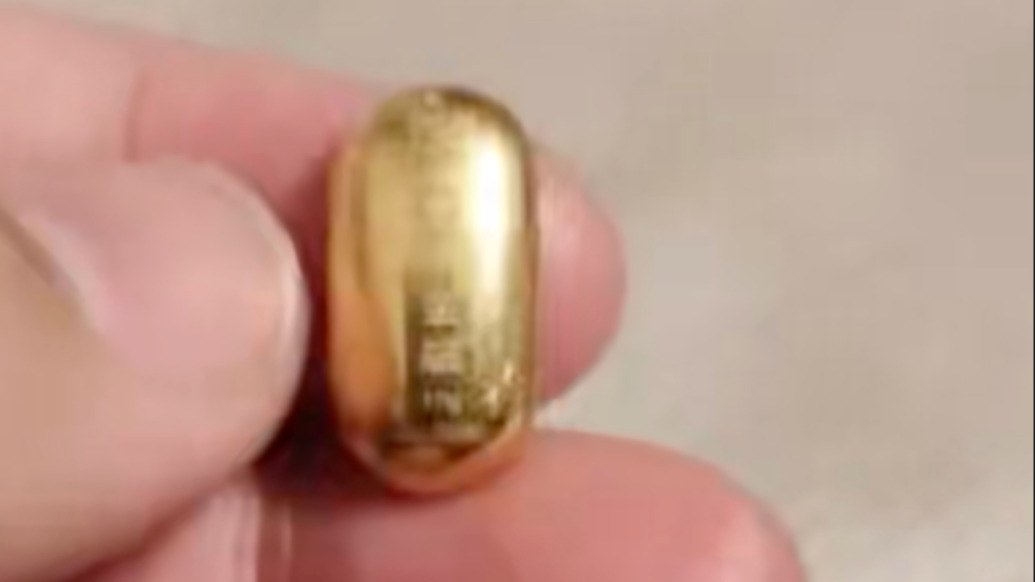 11歲孩子為鍛煉舌頭吞下10克金豆，家人最后還是去了醫(yī)院