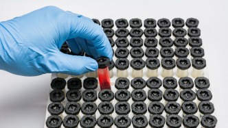 四川平武回應(yīng)集中采集血樣：覆蓋全縣男性，屬于再次核對(duì)采集