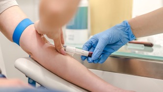 人民日?qǐng)?bào)關(guān)注商業(yè)體檢亂象：過(guò)度檢查、漏診誤診，消耗消費(fèi)者信任