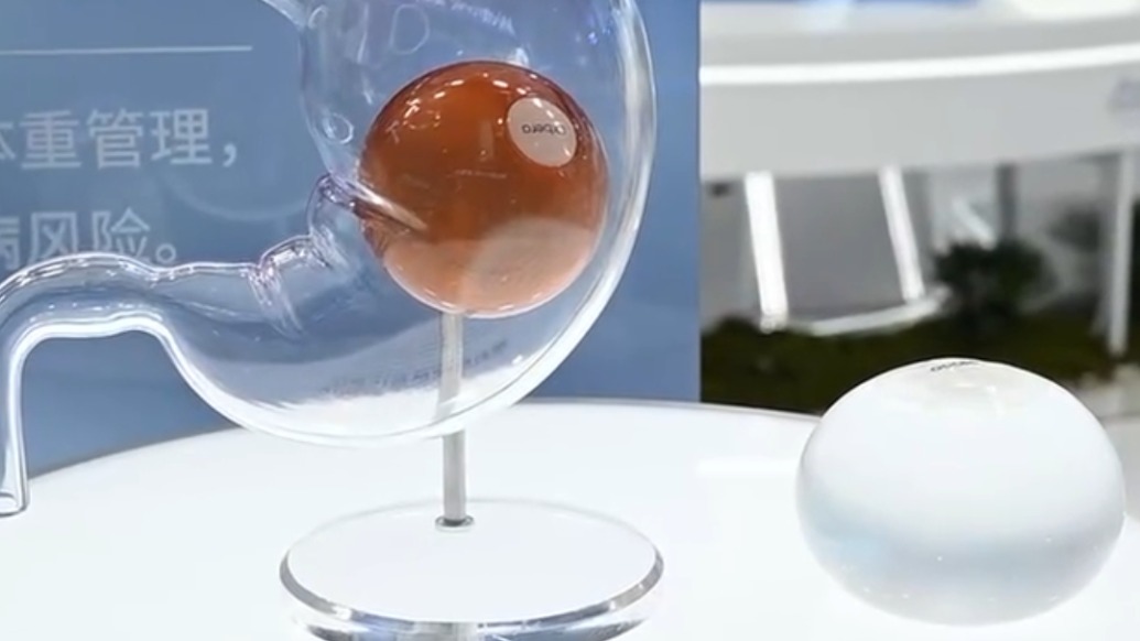 进博直击｜助重度肥胖者一年减重15%，这款 “胃水球”亮相进博会