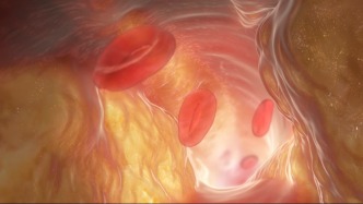 這個(gè)部位很早就開(kāi)始衰老，你注意到了嗎？