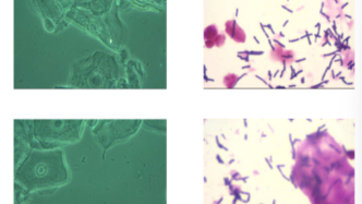 女生每日如何正確清潔衛(wèi)生？