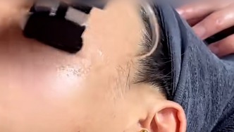 消費(fèi)者稱花兩千元祛斑面部疼痛退款難，武漢市監(jiān)部門(mén)已介入