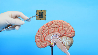 無創(chuàng)植入大腦芯片或能成為現(xiàn)實(shí)