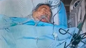 男子在樓道對(duì)女孩行兇，60歲大叔制止身中5刀情況危急