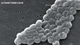 旅行中招，救命的竟然是你没听说过的噬菌体！| 科学世界·探索