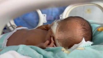 江西衛(wèi)健委通報一早產(chǎn)兒因病情危重離世：患兒家屬已提起訴訟