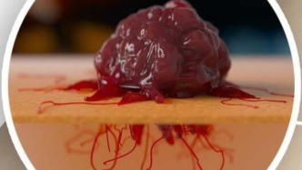 “良性结节，定期随访”是什么意思