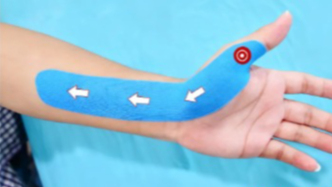 腱鞘炎這個“時代病”  ，正悄悄盯上這3類人！