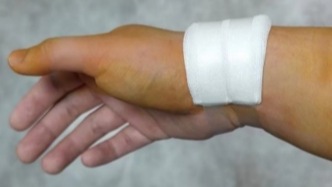 術(shù)后我勉強(qiáng)能捧住包子，卻脫不下也提不起褲子