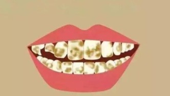 為什么牙齒的顏色會發(fā)黃、發(fā)暗，還有黃褐色的斑紋？