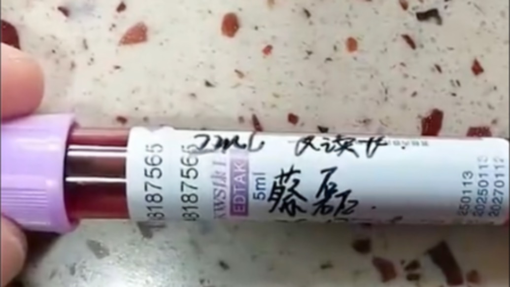 尹燁發(fā)蔡磊血樣，稱將會測序組裝成“完美”基因組