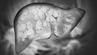 无糖甜味剂可能会损害肝脏