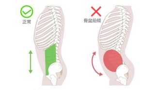 女生真正需要警惕的「小肚子」是這樣的