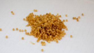 科普 | 砂礫、黃豆、煤渣？其實這是“膽結石”@不吃早餐的人看過來