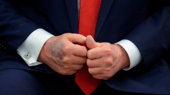 特朗普解釋手背瘀青：阿司匹林吃多了，劑量高于醫(yī)生建議