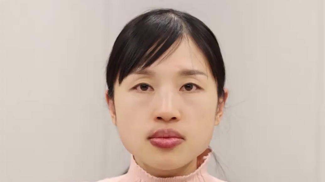 “最快女護士”張水華宣布辭職