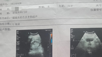 家属称患者检查双肾正常两个月后查出右肾癌晚期，成都郫都区人民医院被指误诊