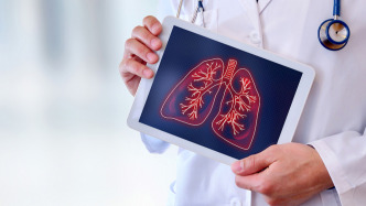 科普｜識別“沉默的殺手”——老年人社區(qū)獲得性肺炎