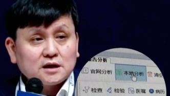 張文宏：我拒絕把AI引入醫(yī)院病歷系統(tǒng)，醫(yī)生需要訓(xùn)練專業(yè)診斷能力