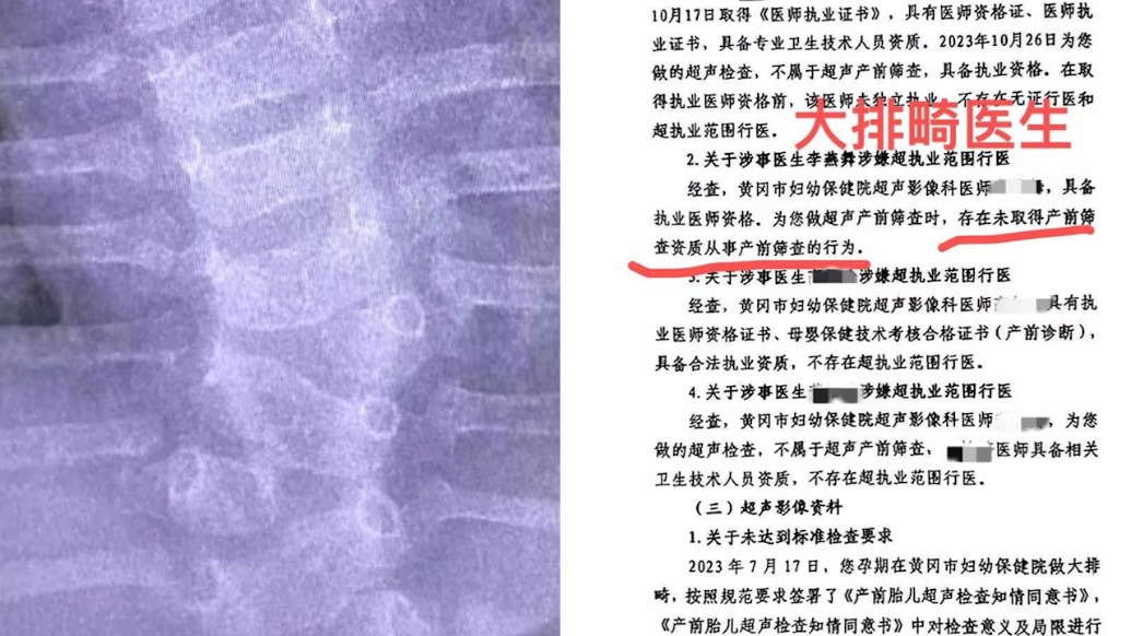 產(chǎn)檢正常嬰兒出生先天畸形？一醫(yī)師不符合資質(zhì)開展產(chǎn)檢，黃岡市婦幼保健院已被罰款警告