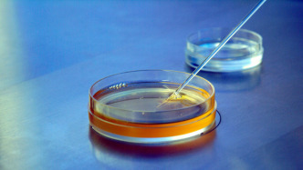 專訪生育力保護(hù)專家阮祥燕：凍存移植的不只是卵巢，而是一個(gè)“小太陽(yáng)”