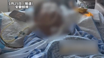 14岁男孩与同学嬉闹摔倒后昏迷已超30天，医生称朝不保夕