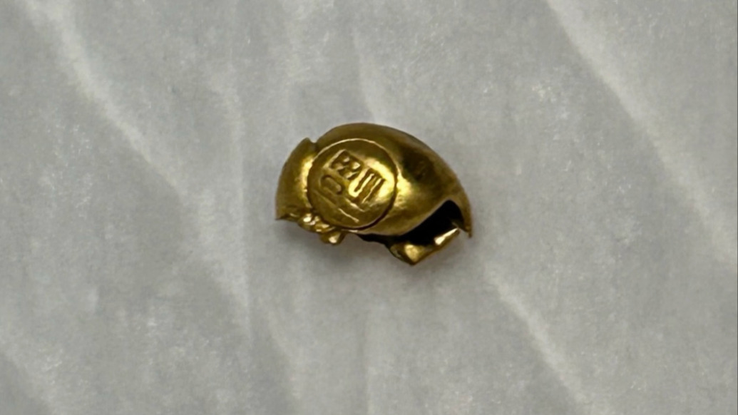 真“吞金獸”！1歲寶寶誤嚼金鎖，醫(yī)生稱黃金已到大腸