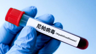 中国科学院武汉病毒研究所：发现口服核苷类药物VV116对尼帕病毒的高效抑制活性