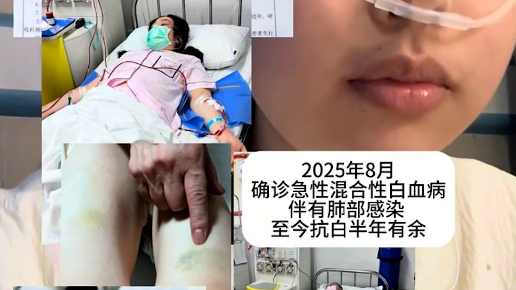 21歲白血病女生急尋親生父母盼配型，發(fā)病后偶然得知非親生