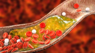 血脂正常了，就可以停他汀嗎？