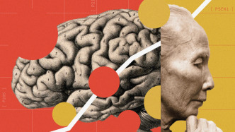 《自然》：中国也许会成为挑战阿尔茨海默病的下一个领跑者