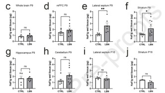 童年创伤如何刻进大脑：一项研究揭示了从压力到行为障碍的清晰路径