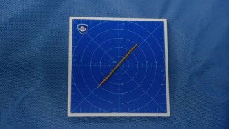 误吞牙签险穿肠，中山内镜专家“探囊取物”10分钟化险为夷