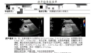 肌酐从正常涨到374，肾病20余年，我走的那些弯路