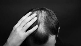 教科书错了！科学家揭示人类头发生长奥秘