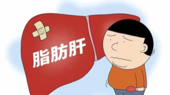 科普 | 不喝酒也會得脂肪肝？“元兇”或許是肚子里的“油”和“菌”