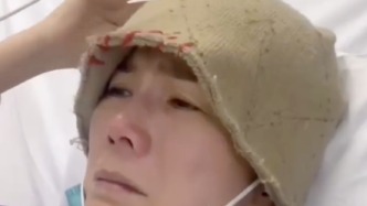 50歲女星乳腺癌擴散至大腦，表示已低調(diào)變賣嫁妝金器