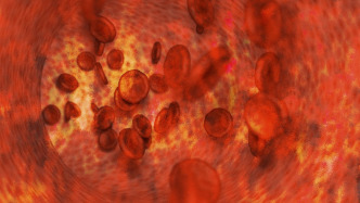 科普｜如何科學(xué)應(yīng)對(duì)頸動(dòng)脈斑塊？哪些斑塊需要警惕？