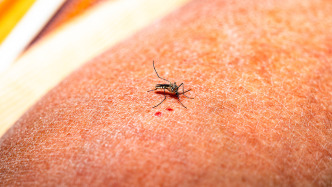 國(guó)家衛(wèi)健委：基孔肯雅熱和發(fā)熱伴血小板減少綜合征納入乙類傳染病管理