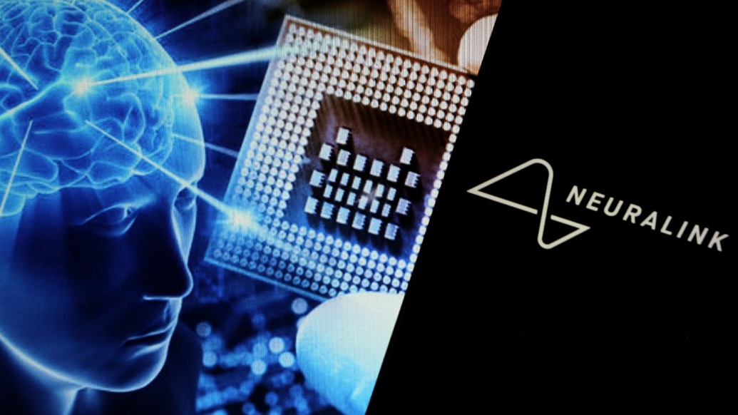馬斯克腦機(jī)芯片重大突破：交流無(wú)需開(kāi)口，失語(yǔ)者用意念發(fā)聲