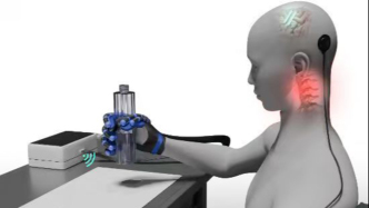 醫(yī)保賦能科技創(chuàng)新，腦機(jī)接口技術(shù)跑出成果轉(zhuǎn)化“上海加速度”