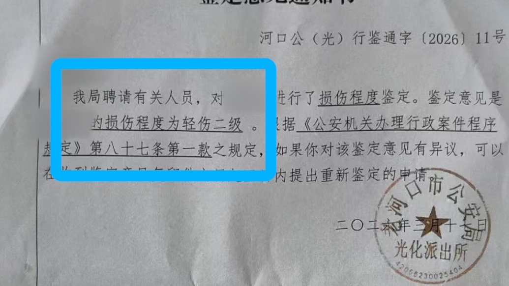 10歲男孩看望離異母親時遭其同居男友毆打致輕傷二級，涉事男子已被刑拘