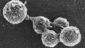 基因組移植讓“僵尸細(xì)胞”死而復(fù)生